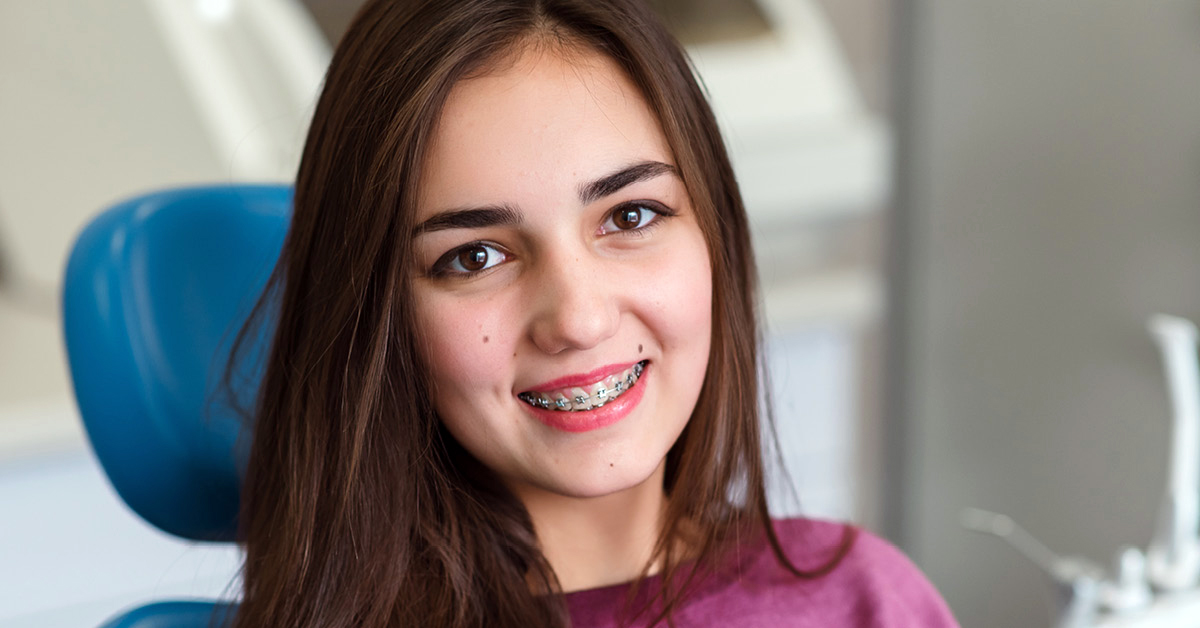 Nhs Braces In Brighton And Hove Splash Orthodontics 