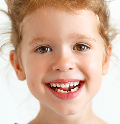 crooked teeth