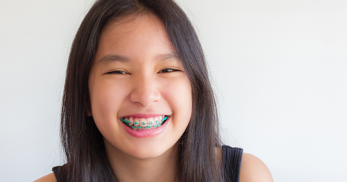 NHS Braces in Brighton & Hove Splash Orthodontics