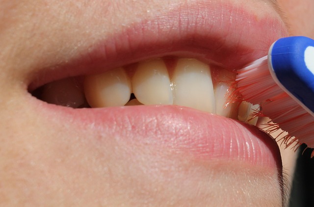 poor brushing with braces