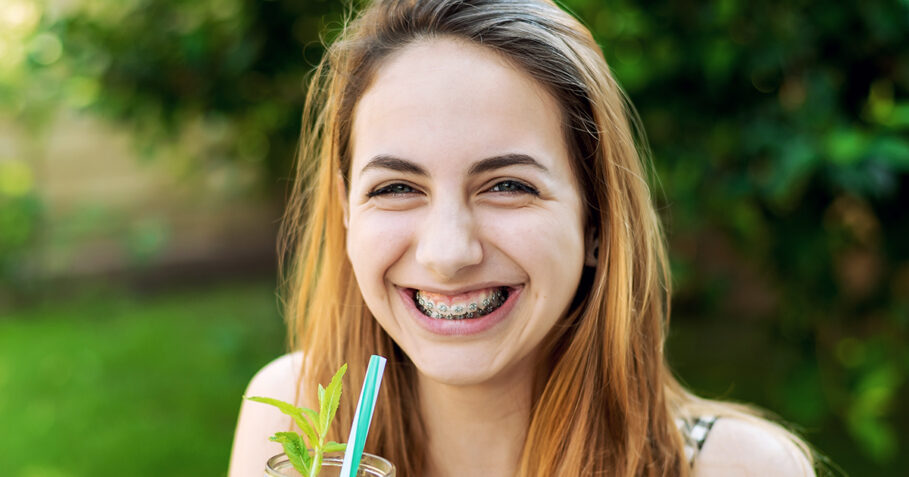 How To Use Wax For Your Braces Splash Orthodontics 