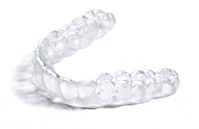 crooked teeth