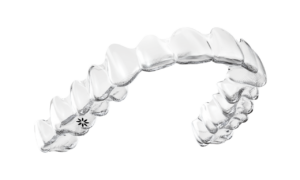 Invisalign in Hove