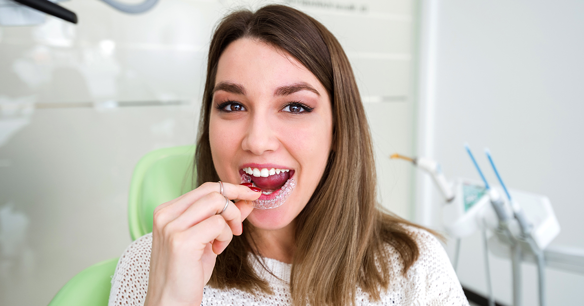 How long to braces take to straighten teeth